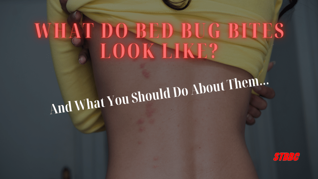 What do Bed Bug Bites Look Like